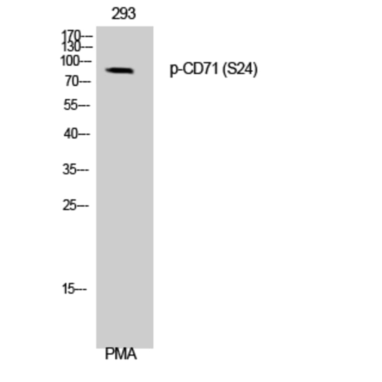 Western Blot - Anti-CD71 (phospho Ser24) Antibody (A0852) - Antibodies.com