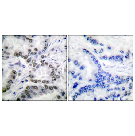 Immunohistochemistry - Anti-CBP (acetyl Lys1535) Antibody (D0019) - Antibodies.com