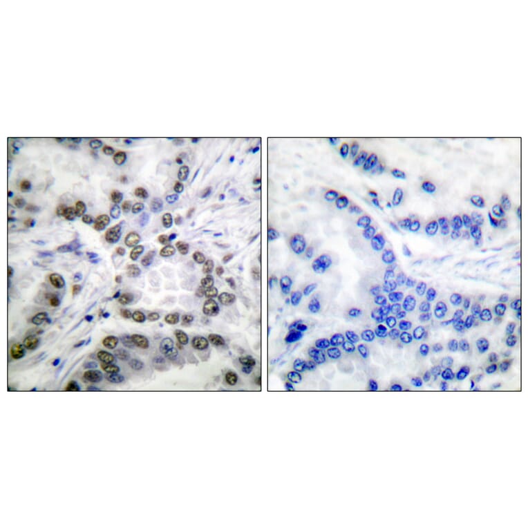 Immunohistochemistry - Anti-CBP (acetyl Lys1535) Antibody (D0019) - Antibodies.com
