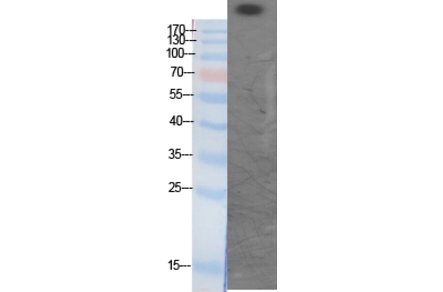 Western Blot - Anti-CBP (acetyl Lys1535) Antibody (D0019) - Antibodies.com