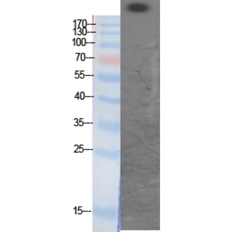 Western Blot - Anti-CBP (acetyl Lys1535) Antibody (D0019) - Antibodies.com