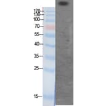 Western Blot - Anti-CBP (acetyl Lys1535) Antibody (D0019) - Antibodies.com