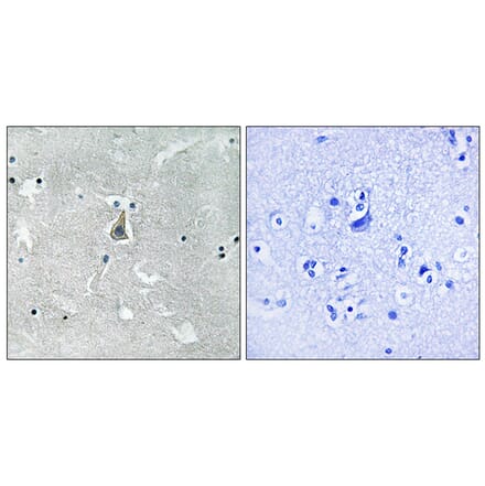 Immunohistochemistry - Anti-Bax (phospho Ser184) Antibody (A8297) - Antibodies.com