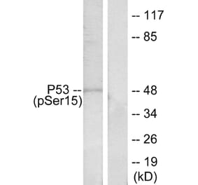 Western Blot - Anti-p53 (phospho Ser15) Antibody (A7180) - Antibodies.com