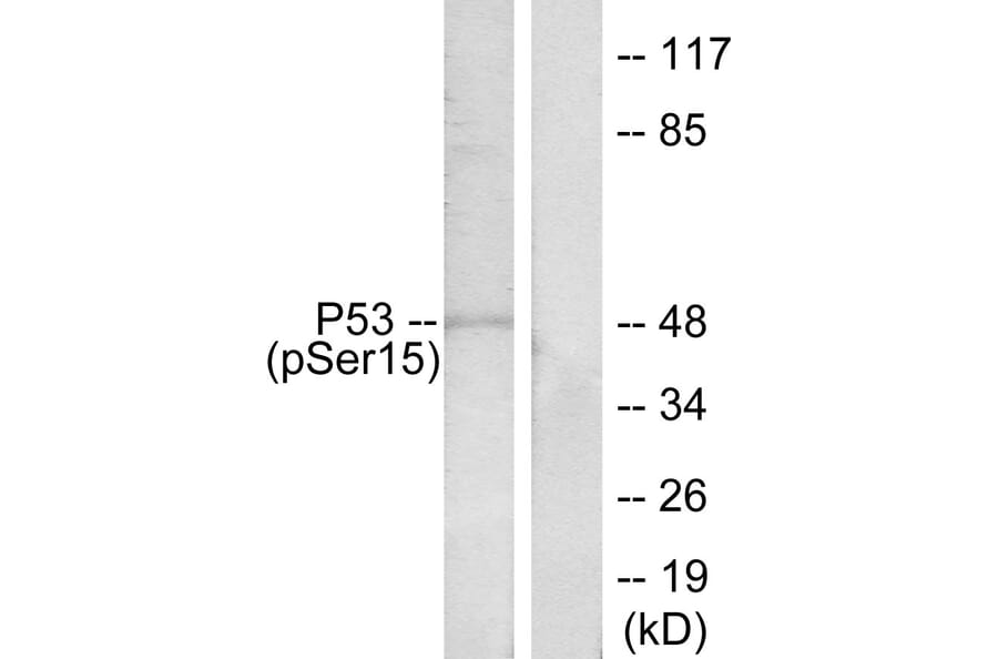 Western Blot - Anti-p53 (phospho Ser15) Antibody (A7180) - Antibodies.com