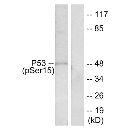 Western Blot - Anti-p53 (phospho Ser15) Antibody (A7180) - Antibodies.com