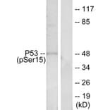 Western Blot - Anti-p53 (phospho Ser15) Antibody (A7180) - Antibodies.com