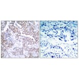 Immunohistochemistry - Anti-p53 (phospho Ser15) Antibody (A7180) - Antibodies.com