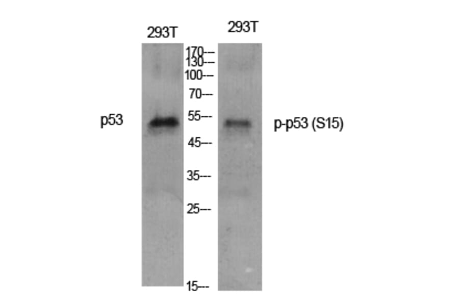 Western Blot - Anti-p53 (phospho Ser15) Antibody (A7180) - Antibodies.com