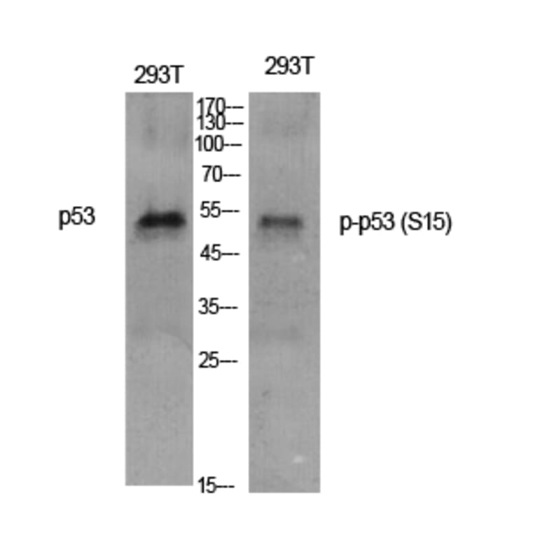 Western Blot - Anti-p53 (phospho Ser15) Antibody (A7180) - Antibodies.com