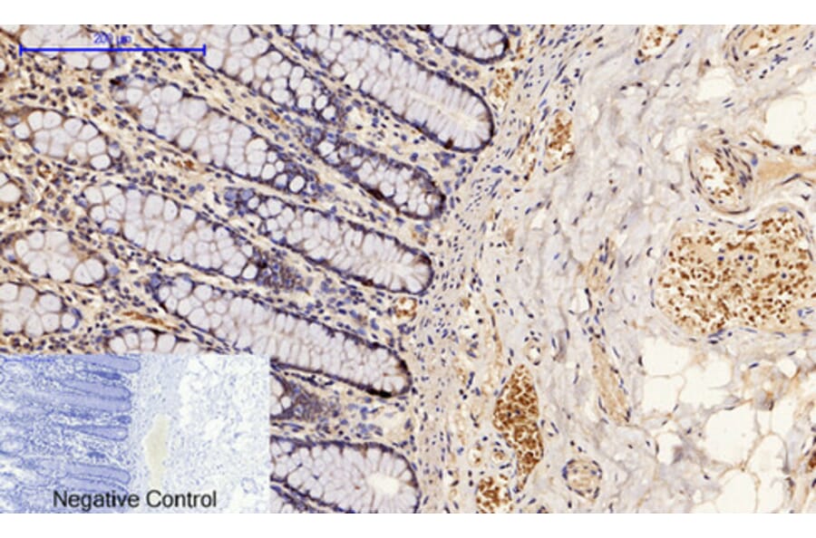 Immunohistochemistry - Anti-p53 (phospho Ser15) Antibody (A7180) - Antibodies.com