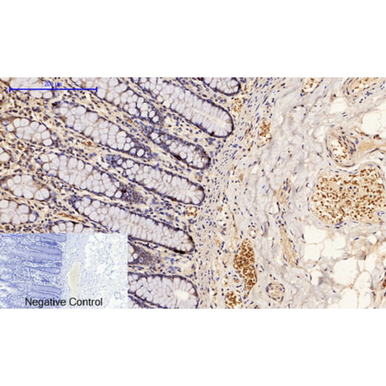 Immunohistochemistry - Anti-p53 (phospho Ser15) Antibody (A7180) - Antibodies.com
