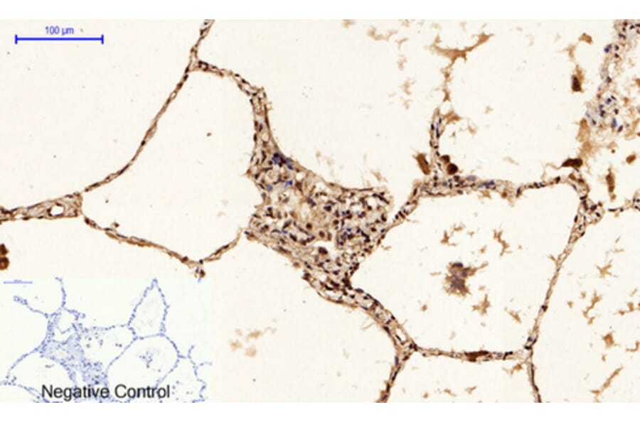 Immunohistochemistry - Anti-p53 (phospho Ser15) Antibody (A7180) - Antibodies.com