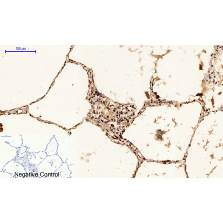 Immunohistochemistry - Anti-p53 (phospho Ser15) Antibody (A7180) - Antibodies.com