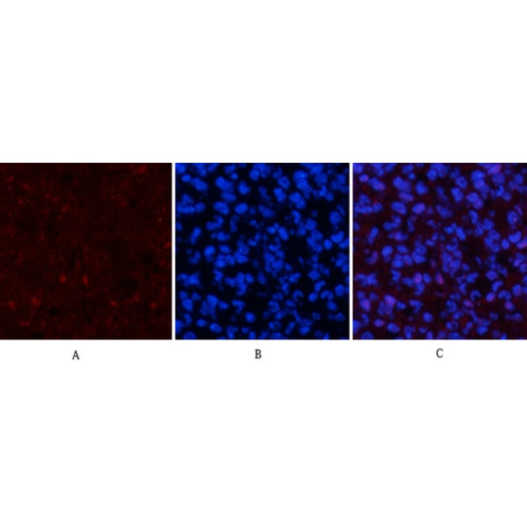Immunofluorescence - Anti-p53 (phospho Ser15) Antibody (A7180) - Antibodies.com