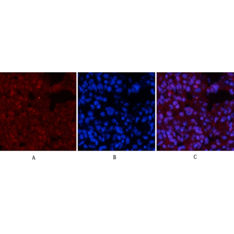 Immunofluorescence - Anti-p53 (phospho Ser15) Antibody (A7180) - Antibodies.com
