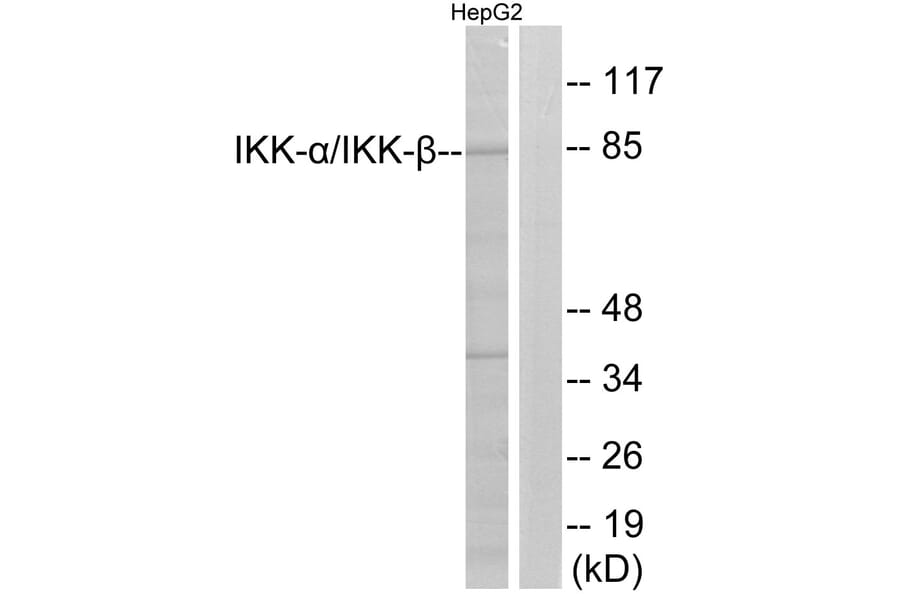 Western Blot - Anti-IKK alpha + beta Antibody (B0440) - Antibodies.com