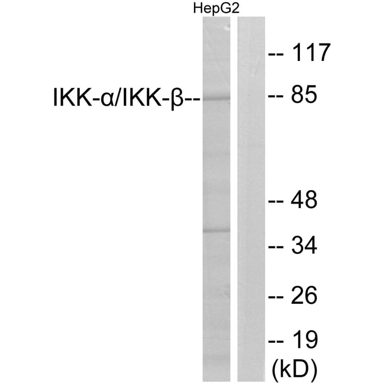 Western Blot - Anti-IKK alpha + beta Antibody (B0440) - Antibodies.com