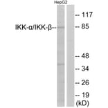 Western Blot - Anti-IKK alpha + beta Antibody (B0440) - Antibodies.com