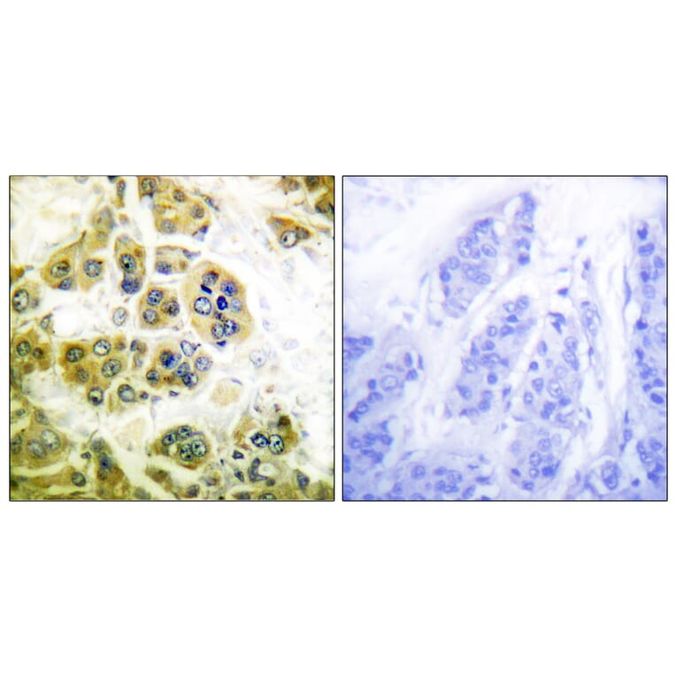 Immunohistochemistry - Anti-IKK alpha + beta Antibody (B0440) - Antibodies.com