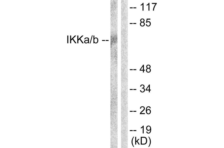 Western Blot - Anti-IKK alpha + beta Antibody (B0441) - Antibodies.com