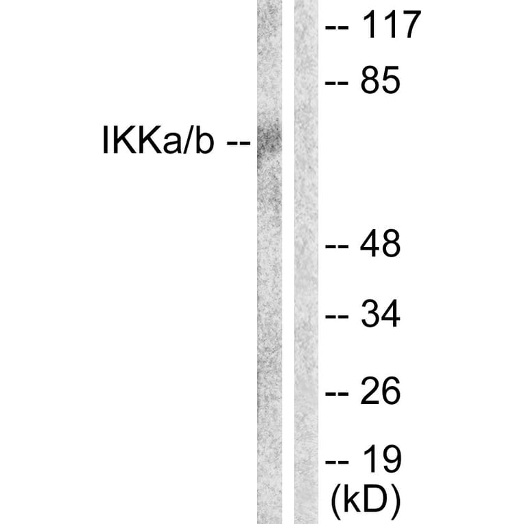 Western Blot - Anti-IKK alpha + beta Antibody (B0441) - Antibodies.com