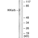 Western Blot - Anti-IKK alpha + beta Antibody (B0441) - Antibodies.com