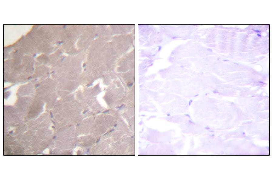 Immunohistochemistry - Anti-IKK alpha + beta Antibody (B0441) - Antibodies.com