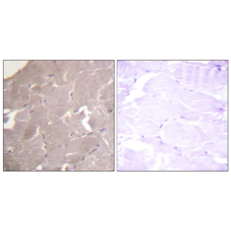 Immunohistochemistry - Anti-IKK alpha + beta Antibody (B0441) - Antibodies.com