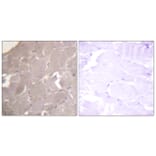 Immunohistochemistry - Anti-IKK alpha + beta Antibody (B0441) - Antibodies.com