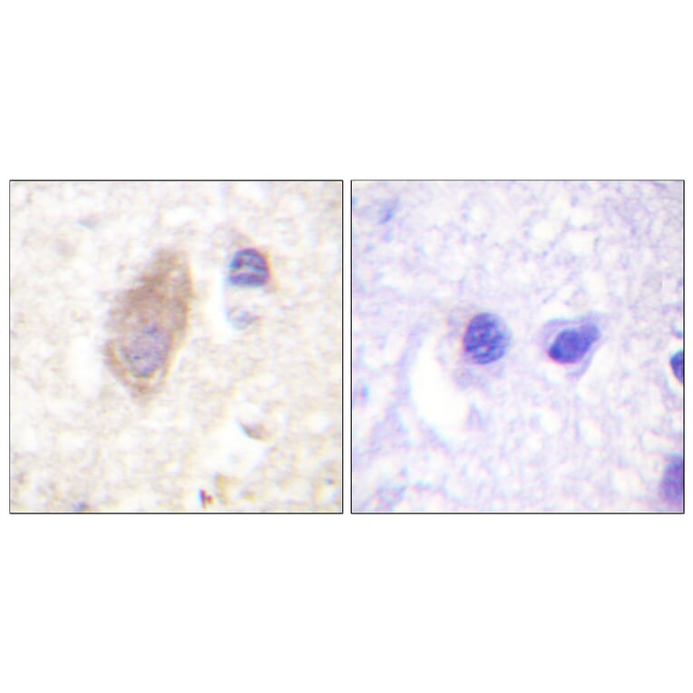 Immunohistochemistry - Anti-Rabphilin 3A Antibody (B0563) - Antibodies.com