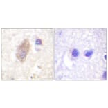 Immunohistochemistry - Anti-Rabphilin 3A Antibody (B0563) - Antibodies.com