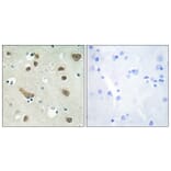 Immunohistochemistry - Anti-14-3-3 gamma Antibody (C12004) - Antibodies.com