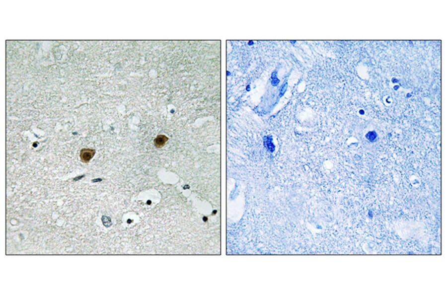 Immunohistochemistry - Anti-AKT1 + AKT2 + AKT3 (phospho Tyr315 + Tyr316 + Tyr312) Antibody (A8075) - Antibodies.com