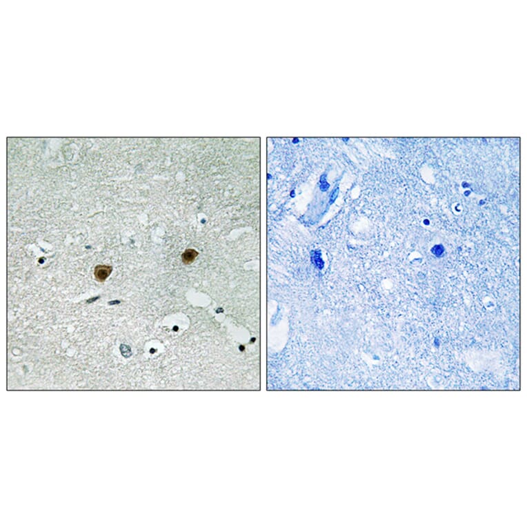 Immunohistochemistry - Anti-AKT1 + AKT2 + AKT3 (phospho Tyr315 + Tyr316 + Tyr312) Antibody (A8075) - Antibodies.com