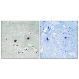 Immunohistochemistry - Anti-AKT1 + AKT2 + AKT3 (phospho Tyr315 + Tyr316 + Tyr312) Antibody (A8075) - Antibodies.com
