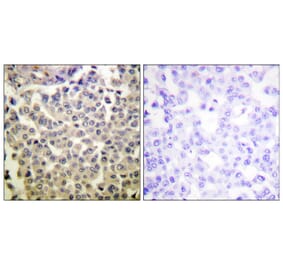 Immunohistochemistry - Anti-PAK1 + PAK2 + PAK3 (phospho Thr423 + Thr402 + Thr421) Antibody (A0540) - Antibodies.com