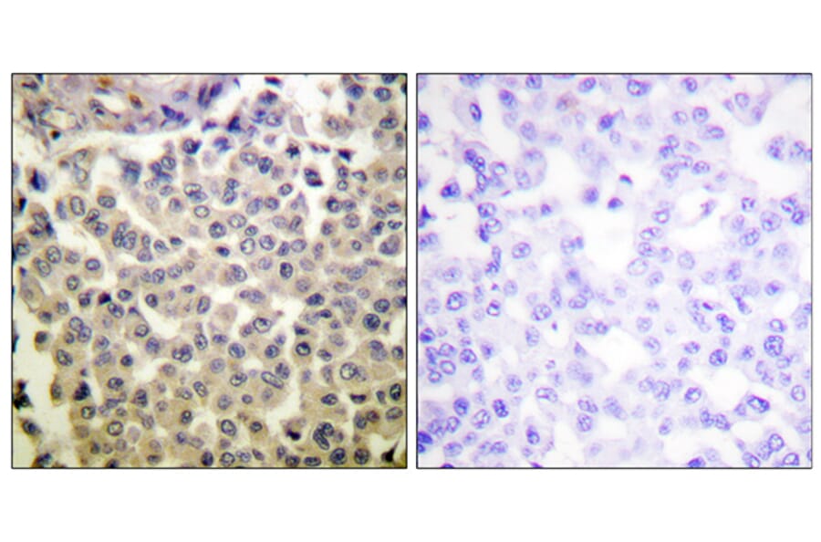 Immunohistochemistry - Anti-PAK1 + PAK2 + PAK3 (phospho Thr423 + Thr402 + Thr421) Antibody (A0540) - Antibodies.com