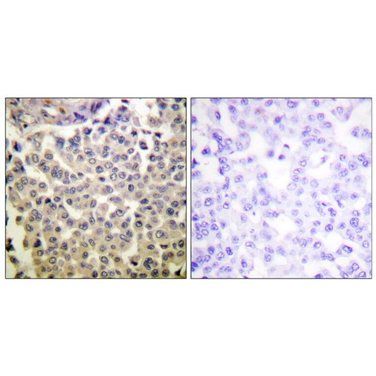 Immunohistochemistry - Anti-PAK1 + PAK2 + PAK3 (phospho Thr423 + Thr402 + Thr421) Antibody (A0540) - Antibodies.com