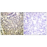 Immunohistochemistry - Anti-PAK1 + PAK2 + PAK3 (phospho Thr423 + Thr402 + Thr421) Antibody (A0540) - Antibodies.com