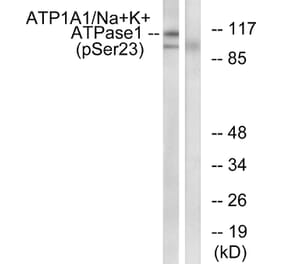 Western Blot - Anti-alpha 1 Sodium Potassium ATPase (phospho Ser23) Antibody (A1136) - Antibodies.com