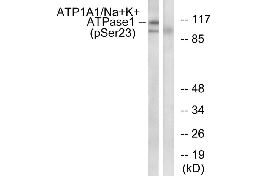 Western Blot - Anti-alpha 1 Sodium Potassium ATPase (phospho Ser23) Antibody (A1136) - Antibodies.com