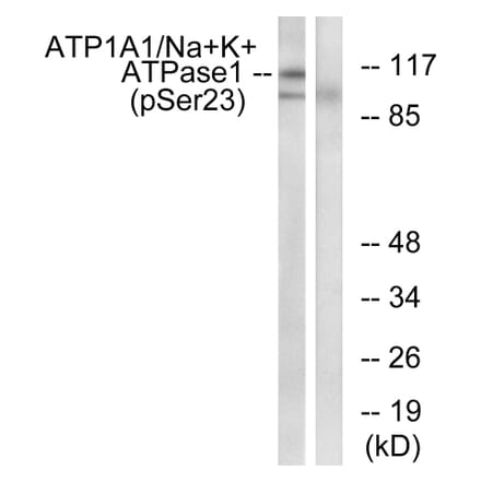 Western Blot - Anti-alpha 1 Sodium Potassium ATPase (phospho Ser23) Antibody (A1136) - Antibodies.com