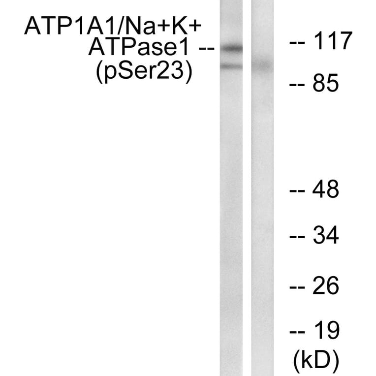 Western Blot - Anti-alpha 1 Sodium Potassium ATPase (phospho Ser23) Antibody (A1136) - Antibodies.com
