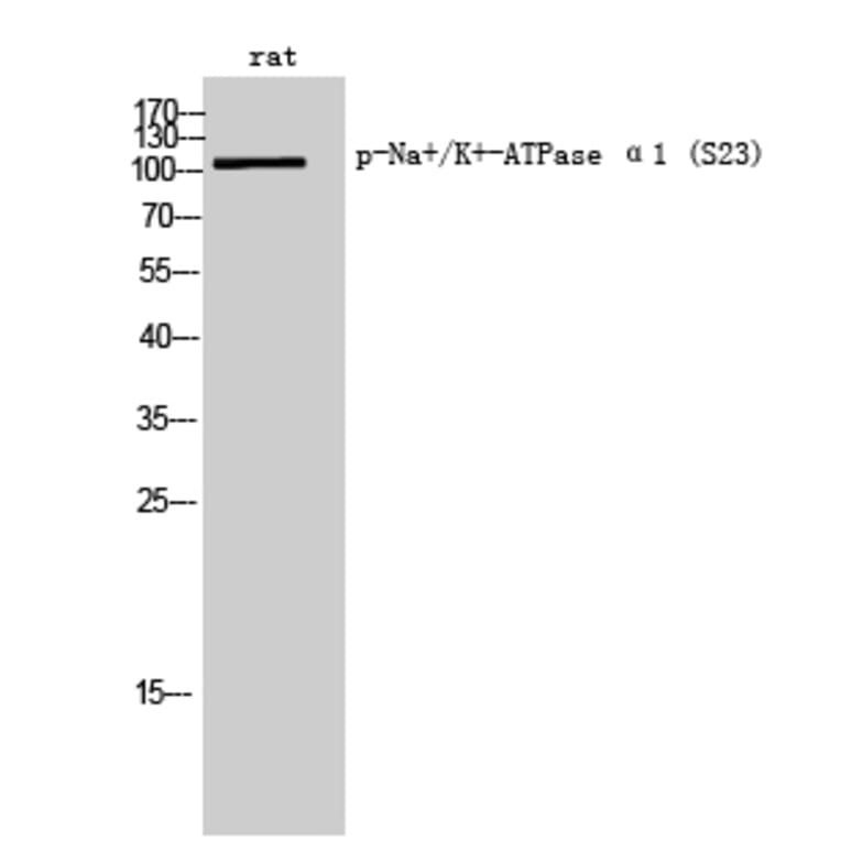 Western Blot - Anti-alpha 1 Sodium Potassium ATPase (phospho Ser23) Antibody (A1136) - Antibodies.com