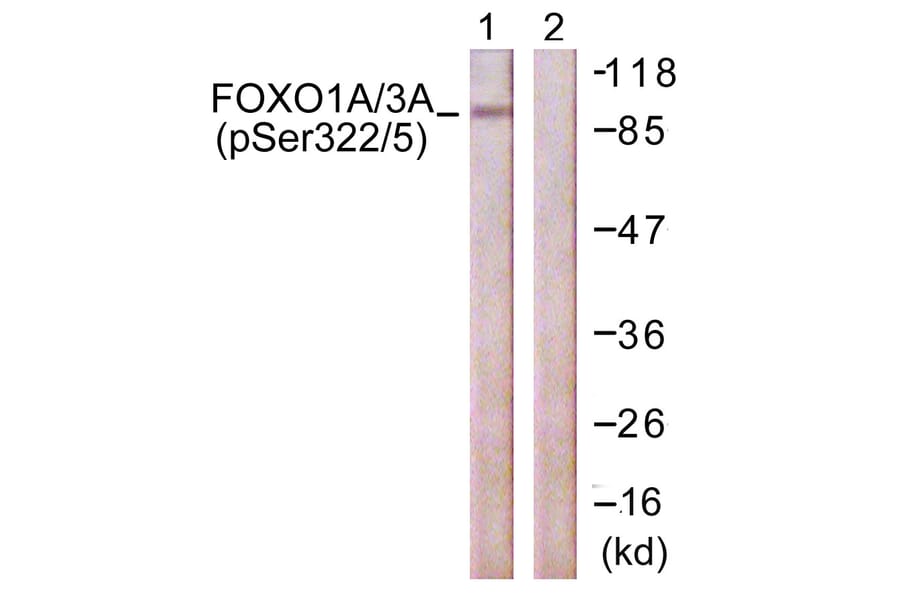 Western Blot - Anti-FOXO1A + FOXO3A (phospho Ser322 + Ser325) Antibody (A0485) - Antibodies.com