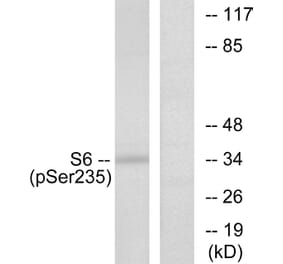 Western Blot - Anti-S6 Ribosomal Protein (phospho Ser235) Antibody (A7214) - Antibodies.com