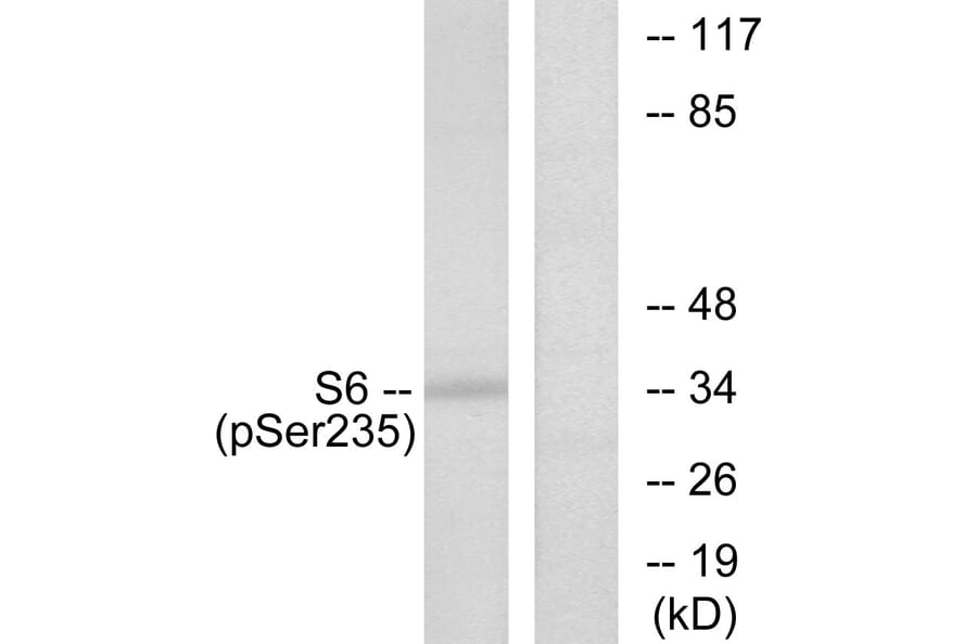 Western Blot - Anti-S6 Ribosomal Protein (phospho Ser235) Antibody (A7214) - Antibodies.com