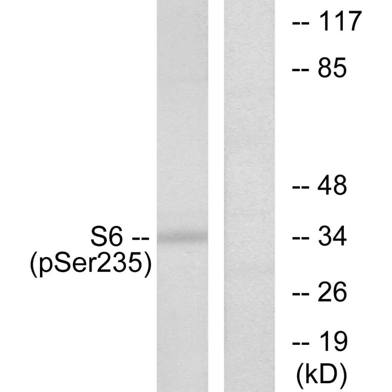 Western Blot - Anti-S6 Ribosomal Protein (phospho Ser235) Antibody (A7214) - Antibodies.com