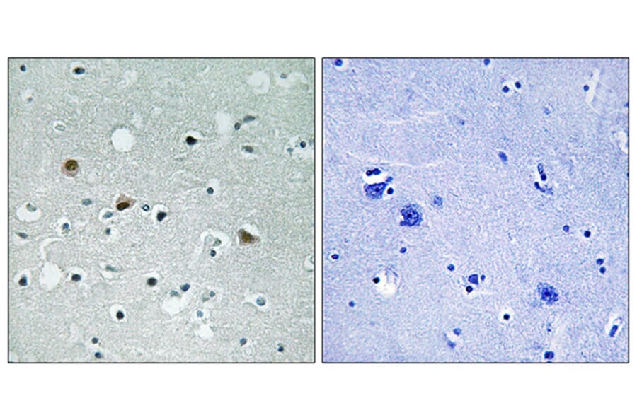 Immunohistochemistry - Anti-LATS1 + LATS2 (phospho Thr1079 + Thr1041) Antibody (A8125) - Antibodies.com